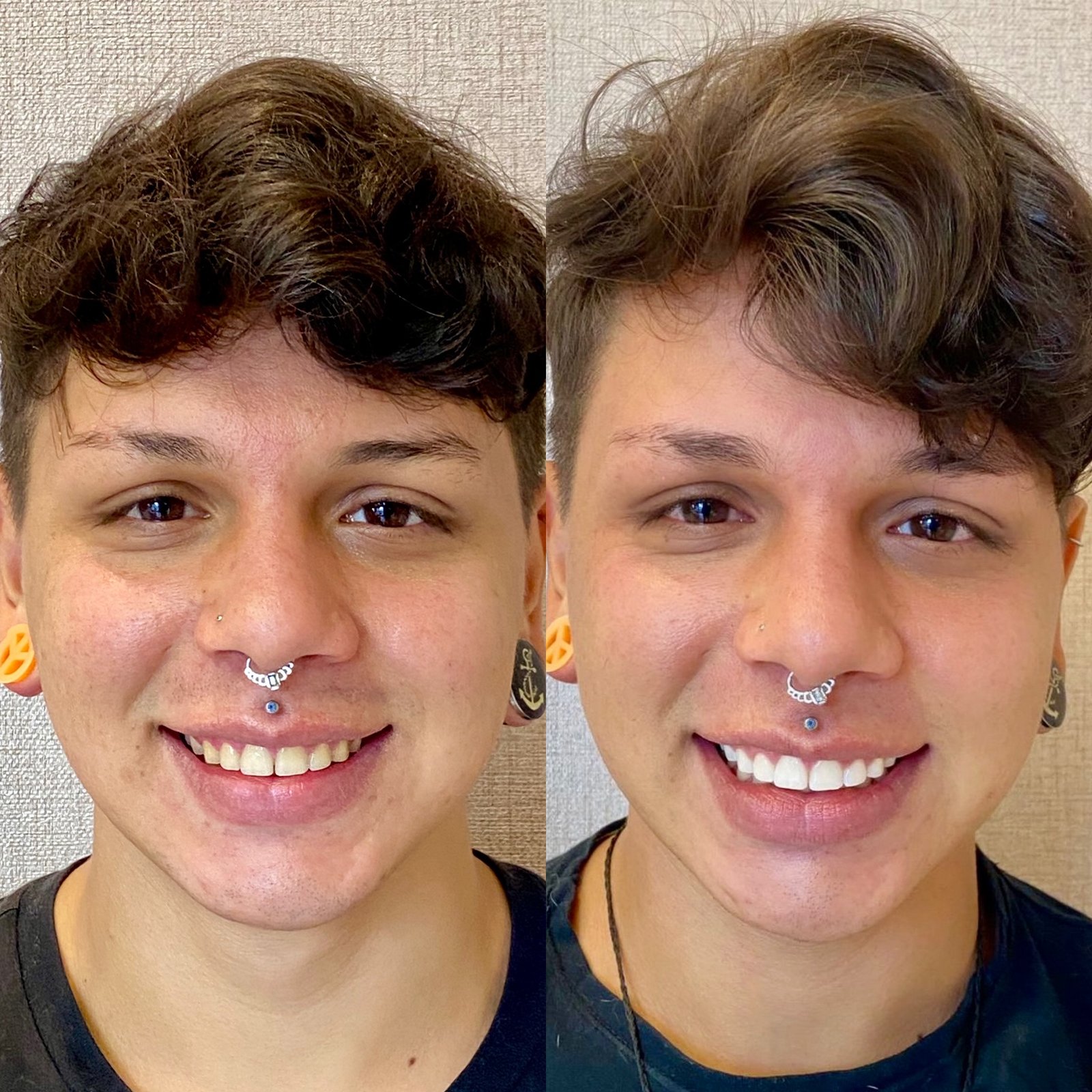 10BB4C10-7D13-43C5-B735-35D245703CE3