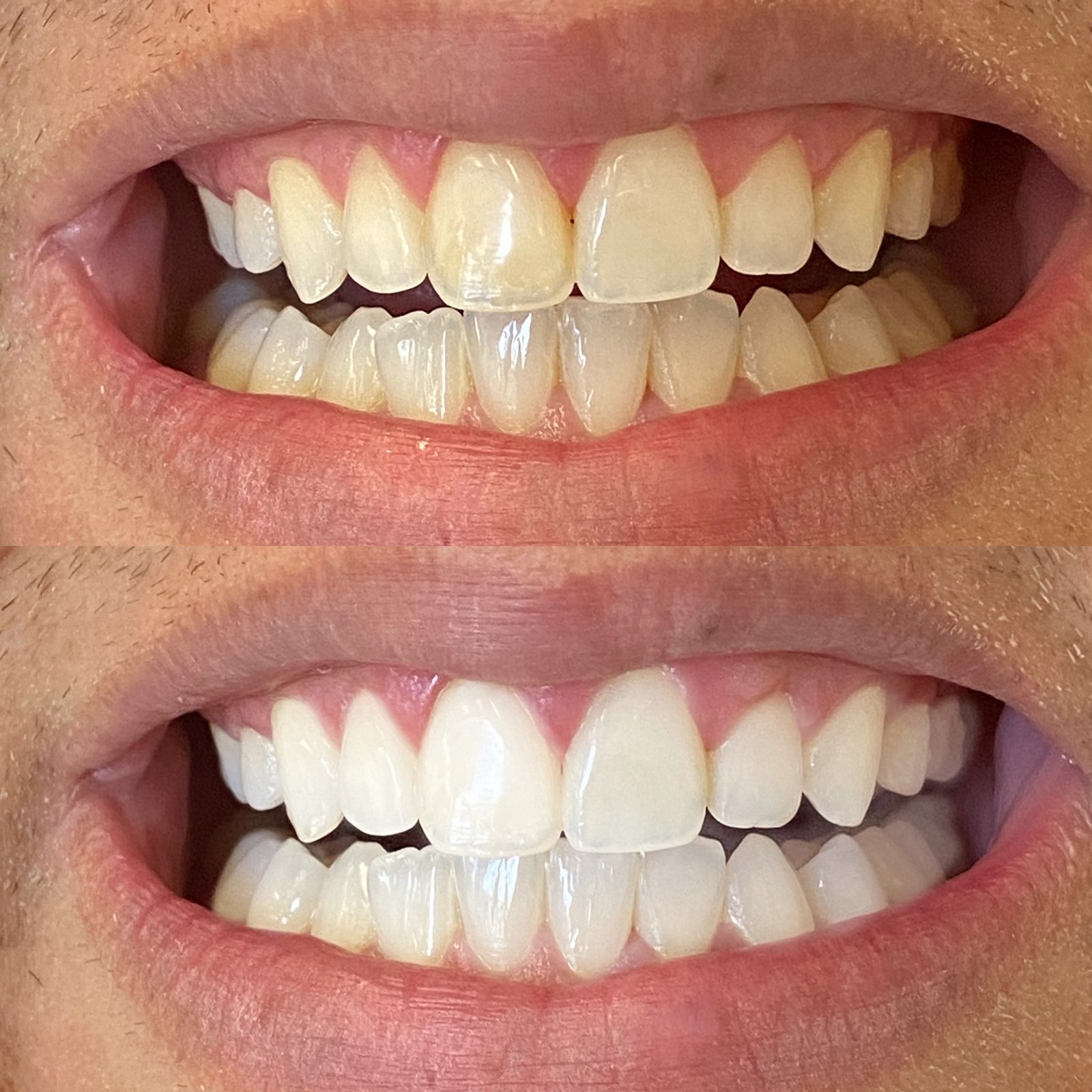 2C3BC179-F3DB-4782-A3B8-506A8881656E