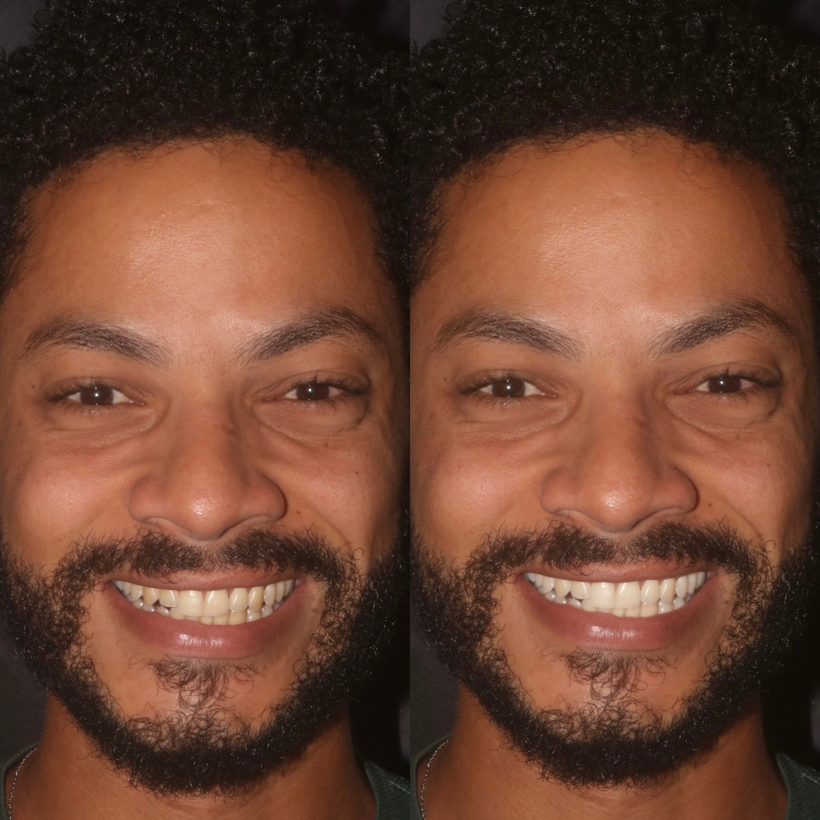 4135F288-C4C1-4024-B755-B9237779BBCD