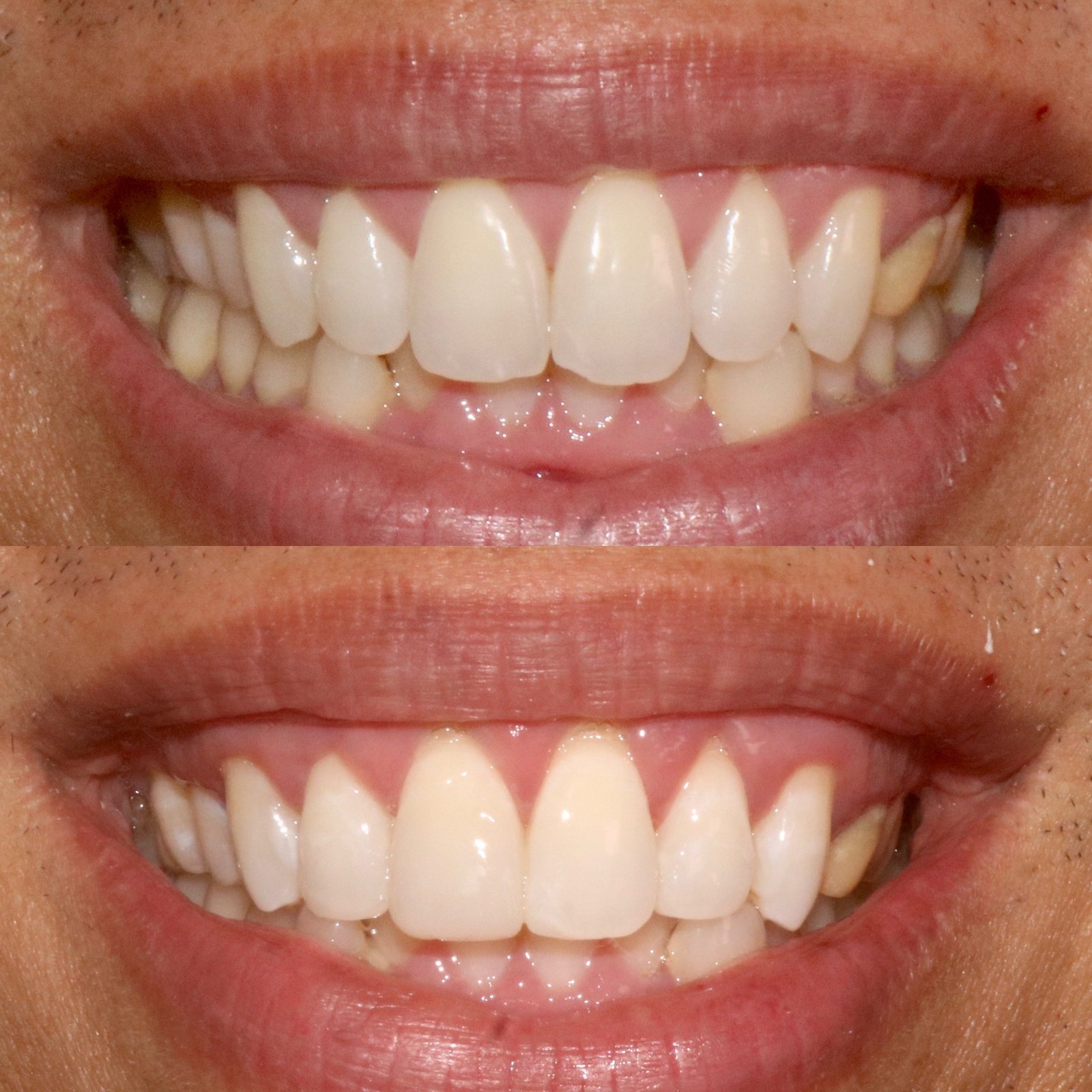 FF16D175-4C4C-4A61-98E2-A092E8EC3C21